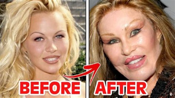 All About Lojain Omran Plastic Surgery With Her Before And After Photos