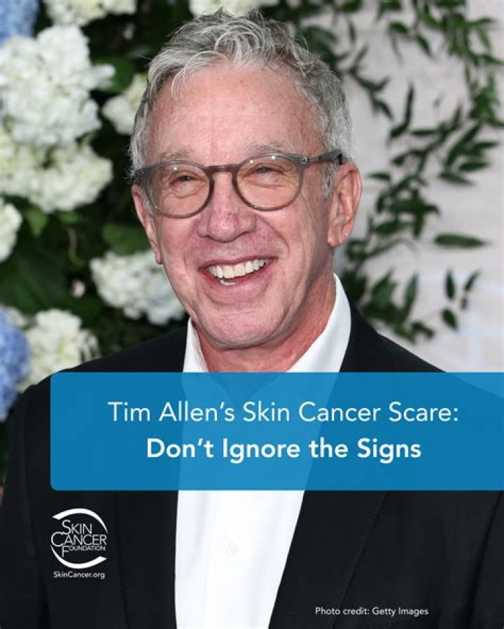 Everything About Steve Allen LBC Cancer