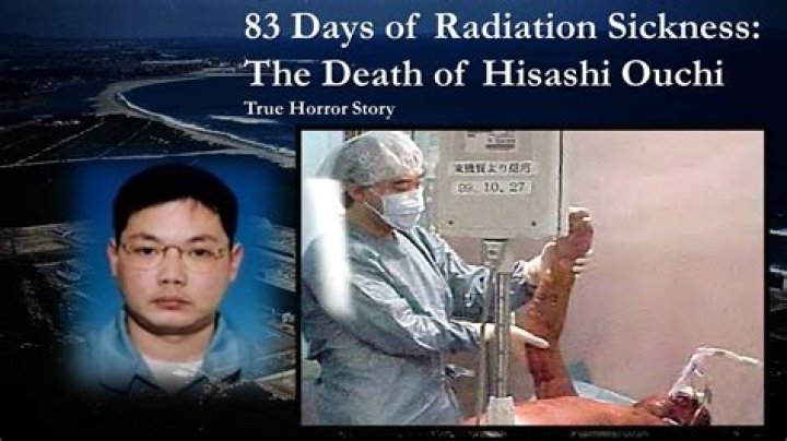 Hisashi Ouchi And The Legacy Of Radiation Exposure